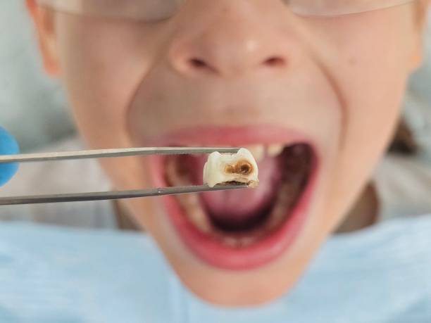 Best Urgent Tooth Repair  in Zeeland, MI